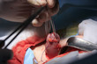 Surgeon rise up the intestine by tube with surgical thread in foreground closeup