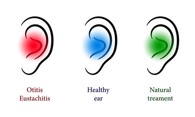 Otorhinolaryngology set with healthy and sore ear