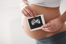 Pregnant Woman Expecting Newborn