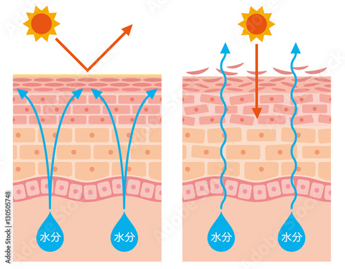 皮膚構造 乾燥肌 断面図 Adobe Stock でこのストックイラストを購入して 類似のイラストをさらに検索 Adobe Stock