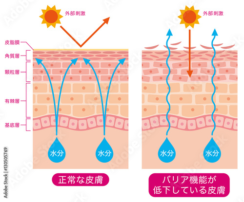 皮膚構造 乾燥肌 断面図 Stock イラスト Adobe Stock