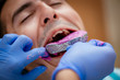 Dental Impression