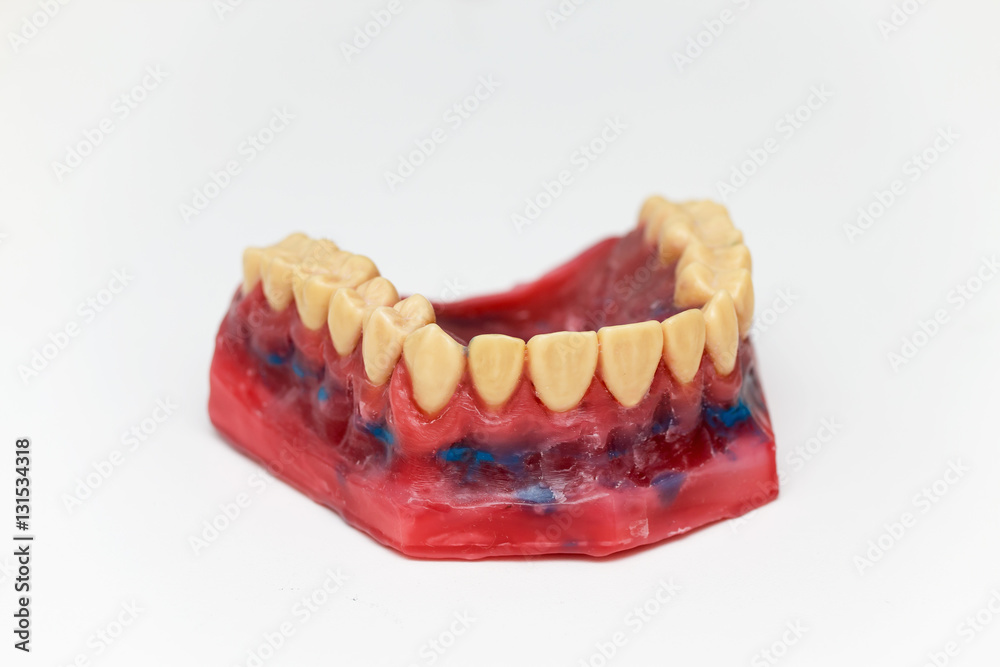 Technical shots of models on a dental laboratory Stock Photo | Adobe Stock