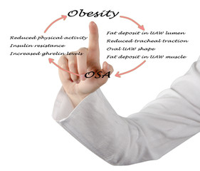 Wall Mural - Relationship between OSA and obesity