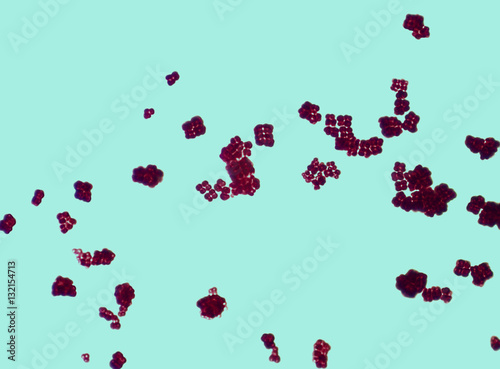 Cubic structures of Sarcina bacterium under a microscope - Buy this
