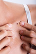 © plprod - femme examinant un grain de beauté sur la peau