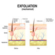 Exfoliation or peel is cosmetic procedures