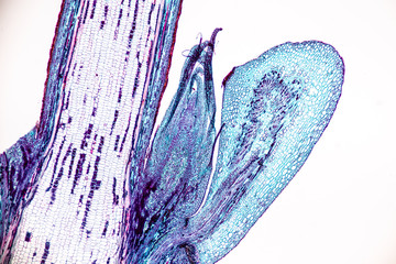 Wall Mural - Background of Abscission layer cell under the microscope.