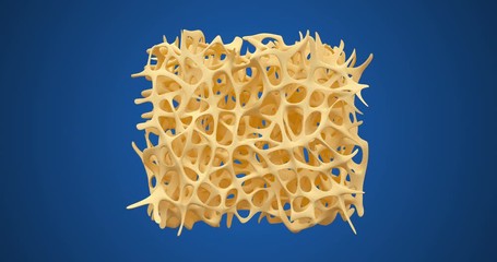 Wall Mural - Developing of human bone osteoporosis spongy texture from normal to sick, time lapse 3d animation isolated ob blue background