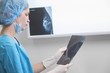 woman doctor or nurse in surgery outfit is holding a mammogram in front of x-ray illuminator