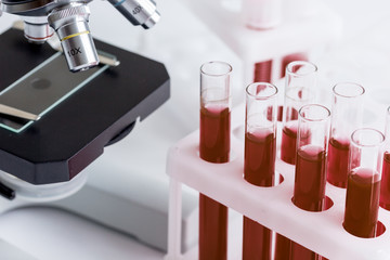 blood in glass tubes on background of microscope