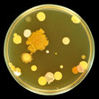 Big colorful colonies of bacteria on a petri dish (agar plate) isolated on black background.  Nutient agar used for bacteria growth. Isolation by pen.