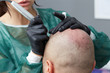 professional tattooist making permanent make up on man skin head - Tricopigmentation