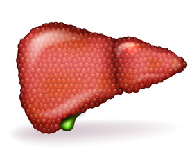 Sticker - Liver disease anatomy illustration, variety of illnesses can affect the liver- cirrhosis, alcohol abuse, hepatitis