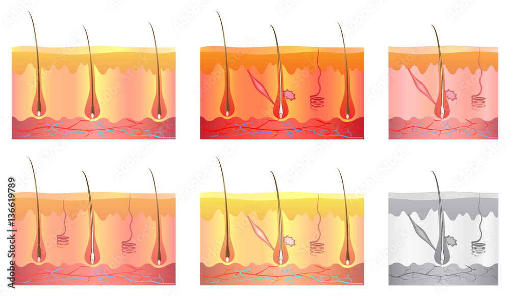 Human skin cross-section, hair structure, set, isolated on white ...