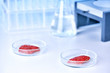 Meat samples in Petri dishes on table at laboratory