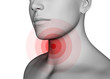 Sore Throat Concept - 3D