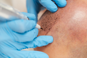 professional tattooist making permanent make up tricopigmentation