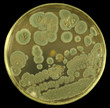 Colonies of  allergenic fungus from air spores on a petri dish (agar plate) manually isolated on a black background. Nutrient agar media  used.  Focus on full depth.