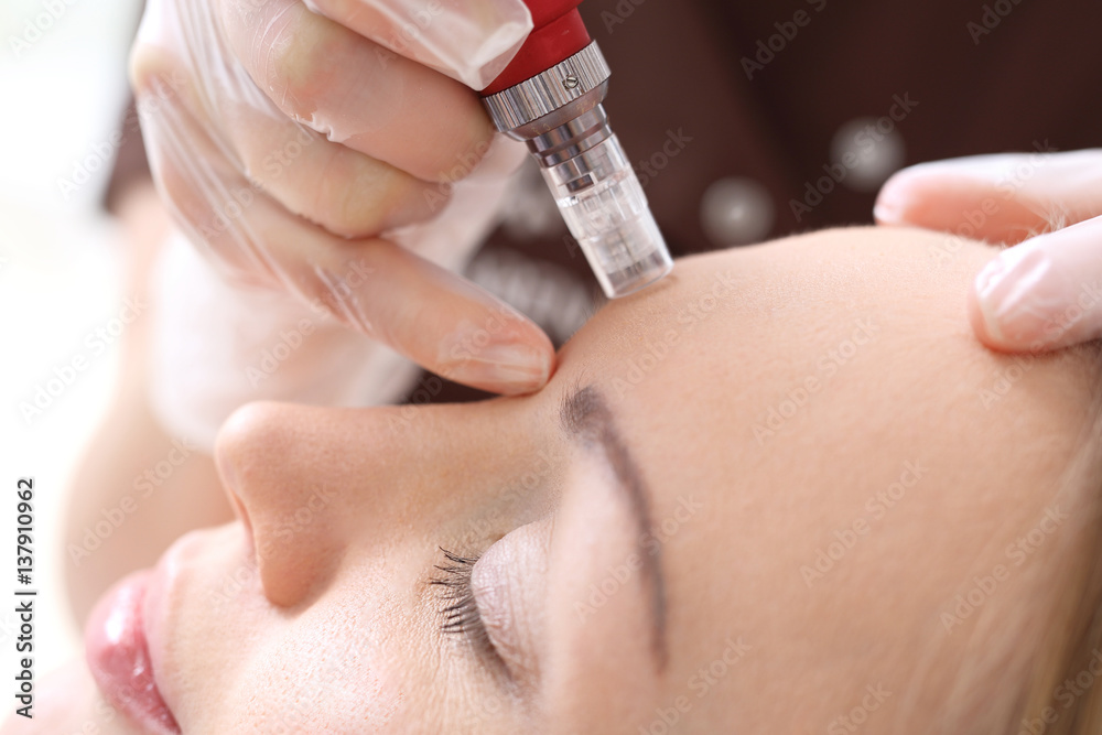 Kosmetyczka wykonuje zabieg mezoterapii igłowej na twarz kobiety - obrazy, fototapety, plakaty 