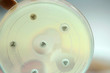 Keyhole test ESBLs positive by diffusion method test for gram negative bacilli;  focus on all agar surface