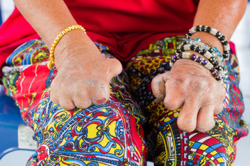 closeup female asian hands of old woman suffering from leprosy amputated hands with colorful clothing