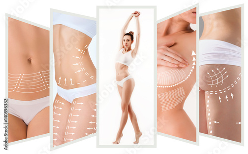 Fotomural The cellulite removal plan. White markings on young woman body