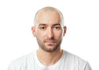 hair loss concept. portrait of young bald man on white background