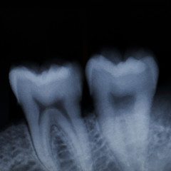 teeth x-ray for pattern and design