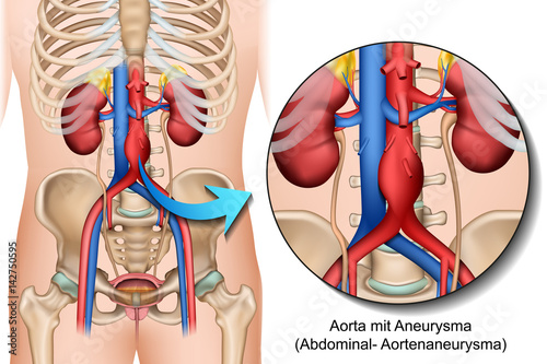 Nowoczesny obraz na płótnie Ilustracja anatomii brzucha