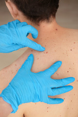 Wall Mural - Dermatologist examining patient in clinic