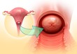 © Science RF - Cervix anatomy, illustration