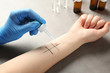 © Africa Studio - Patient making allergy test in laboratory