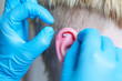 The operation to install the piercing in the ear...