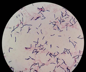 smear of human blood culture gram's stained with gram positive bacilli bacteria, under 100x light mi