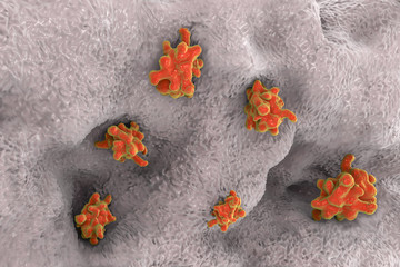 Poster - Entamoeba histolytica protozoan invading intestine. Parasite which causes amoebic dysentery and ulcers. 3D illustration