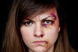 Beaten angry young woman with bruises on her face. Abuse, violence, close up portrait