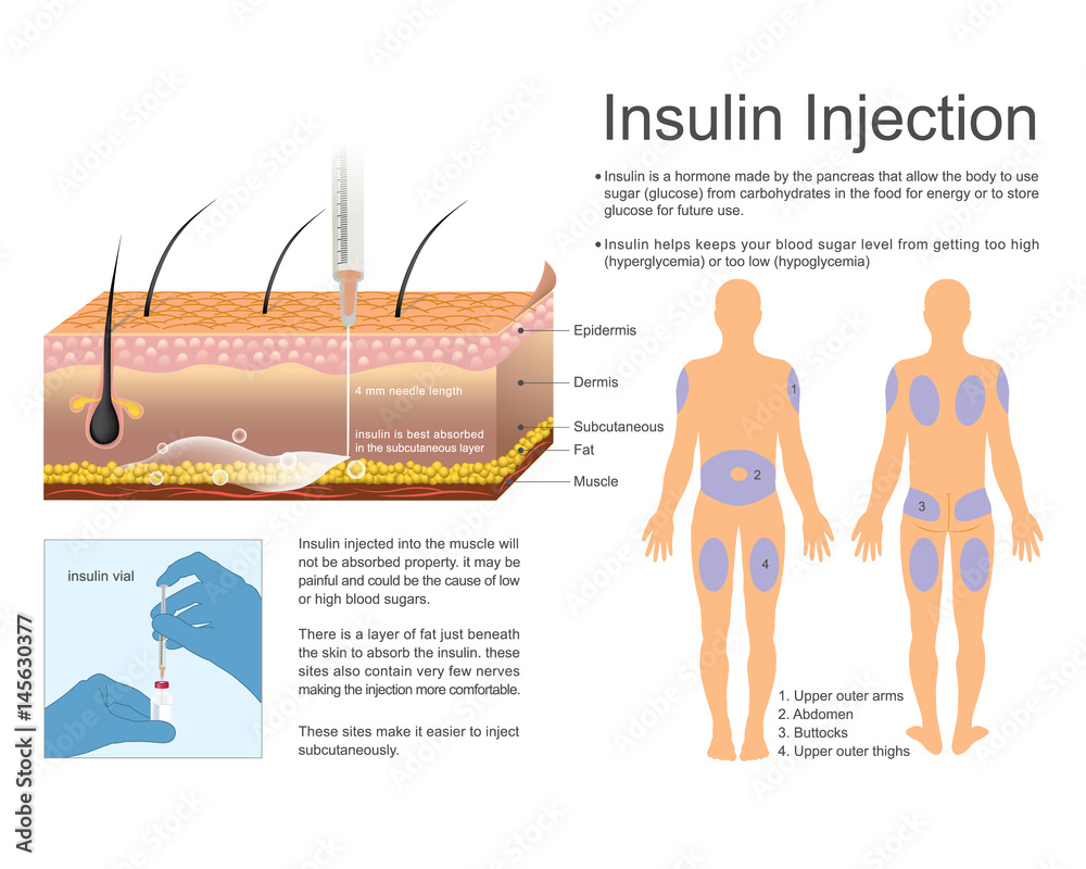 Insulin Injection Stock Vector | Adobe Stock