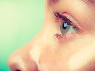 Close up woman in facial peel off mask.