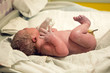 © saulich84 - Newborn after birth with umbilical cord lies on a white cloth diaper