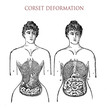 Vintage fashion lifestyle, corset usage and unhealthy deformation