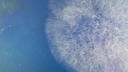 Sticker - Growing mushrooms in a petri dish, Growth Colony Of Microbes And Pathogenic Fungi In Petri Dish