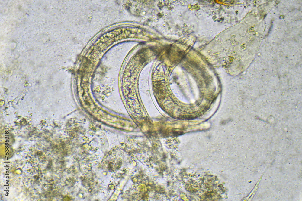 Strongyloides stercoralis (threadworm) in stool, analyze by microscope ...