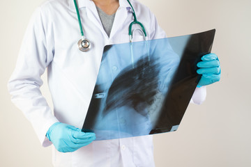 doctor checking chest x-ray film at ward hospital.