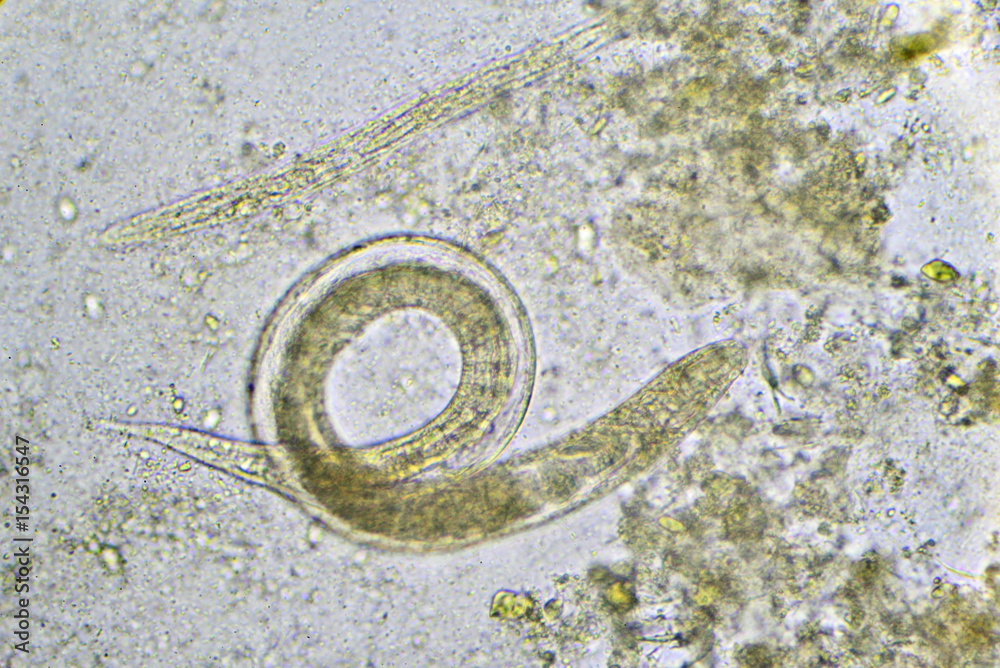 Threadworm Stool Sample Strongyloides stercoralis (threadworm) in stool, analyze by microscope ...