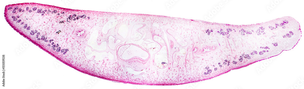 Fluke Parasite >> Photo Art Print Liver Fluke Fasciola Hepatica A Parasite Fluke Parasite >> Photo Art Print Liver Fluke Fasciola Hepatica A Parasite