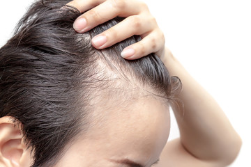 Bald man or woman worry about his or her less hairline on white background isolated