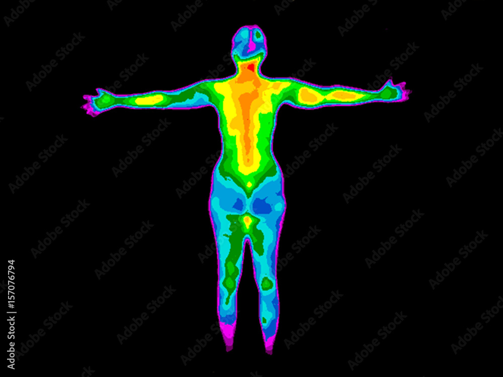 Thermographic image of the back of the whole body of a woman with photo ...