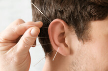 Man's Ear With Needles, Closeup. Acupuncture Concept