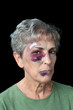 © cherylvb - Beaten elderly woman